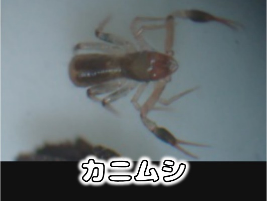 カニムシの顕微鏡写真